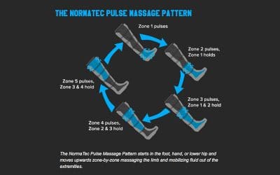 The Ultimate Guide to NormaTec Recovery Therapy